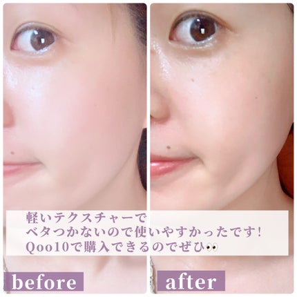 ポアタイトニングアンプル /REJURAN COSMETICS/美容液を使ったクチコミ(4枚目)