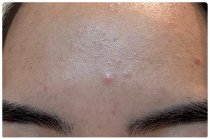 エターナルアイクリーム 8g/リュバンブラン/アイケア・アイクリームを使ったクチコミ(3枚目)