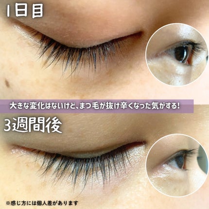 湘南美容まつ毛美容液PREMIUM/湘南美容/まつげ美容液を使ったクチコミ(4枚目)