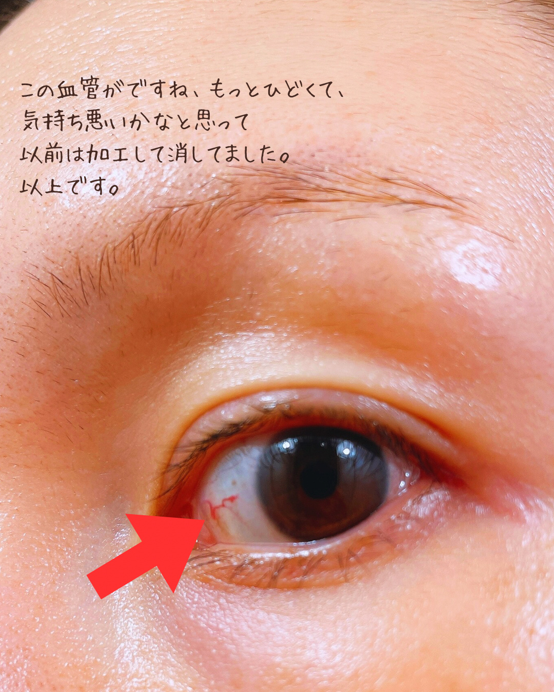 Eyepa/Eyepa/健康サプリメントを使ったクチコミ（3枚目）