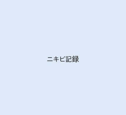 アゼライン酸15 インテンスカーミングセラム/Anua/美容液を使ったクチコミ(1枚目)