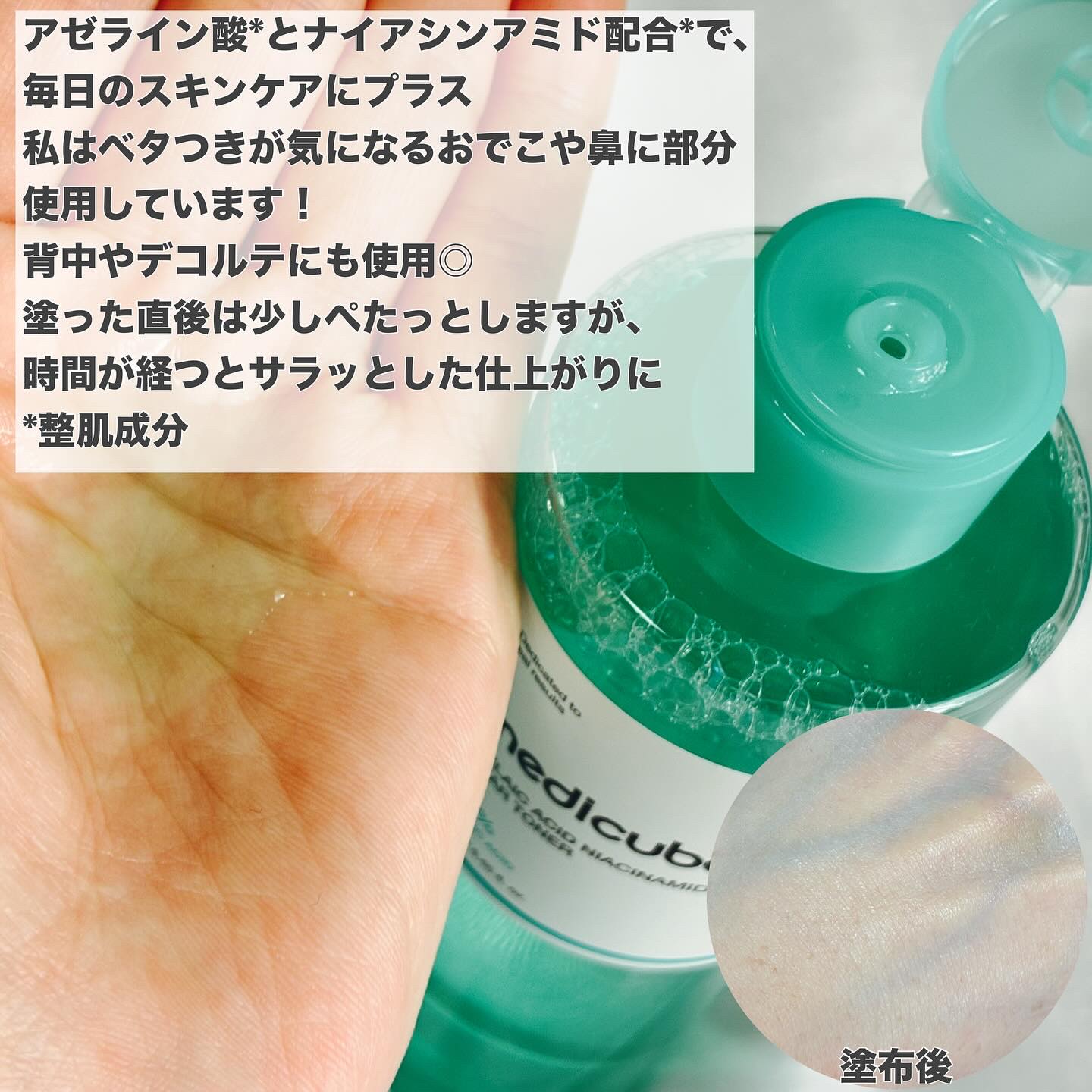 アゼライン酸ナイアシンアミドクリアトナー/MEDICUBE/化粧水を使ったクチコミ（2枚目）