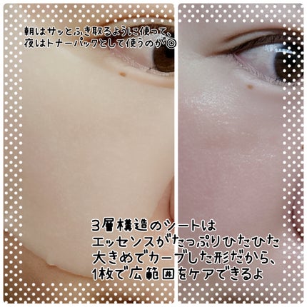 ポアタイトニングトナーパッド/REJURAN COSMETICS/トナーパッドを使ったクチコミ(3枚目)