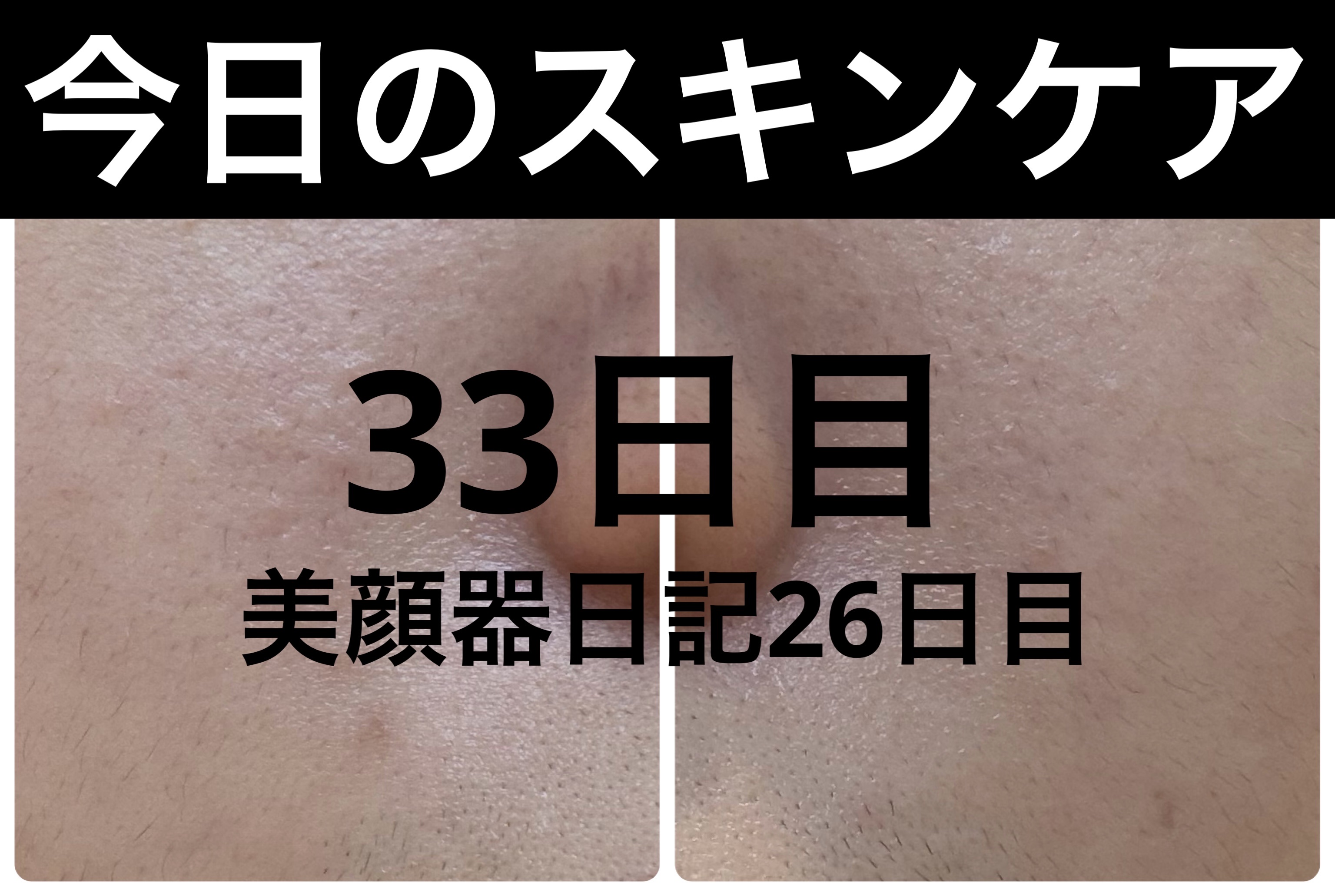 薬用雪肌精 ブライトニング クレンジング オイル[医薬部外品] 150mL/雪肌精/オイルクレンジングを使ったクチコミ（1枚目）