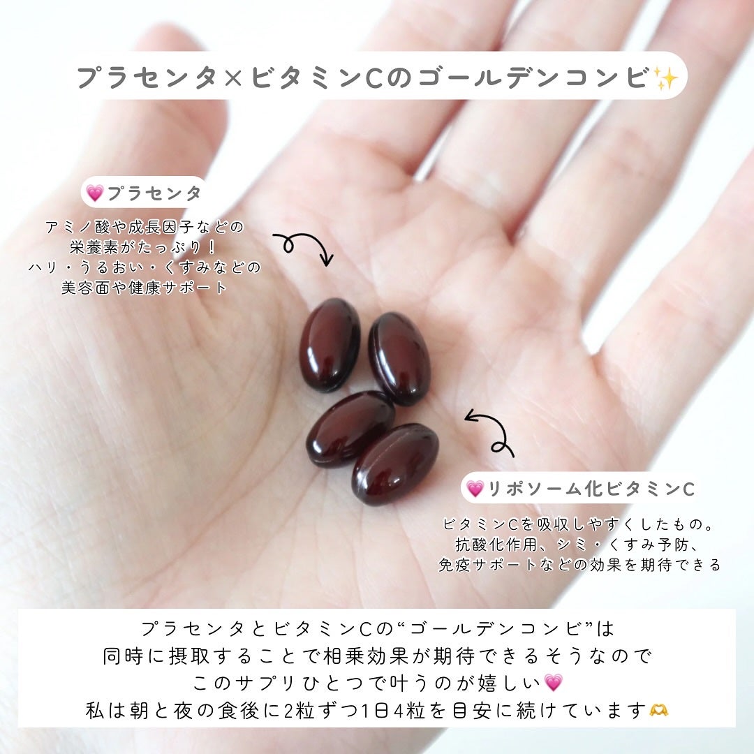 プラセンタ20000 リポソームビタミンC/マルマンH&B/美容サプリメントを使ったクチコミ(4枚目)