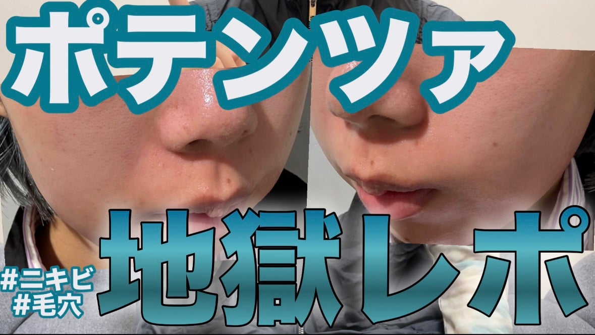 ãã¡ãð°ã¹ãã³ã±ã¢ããã on LIPS ãYouTubeæçš¿ããŸãã~ð°ã¿ãŠãâ©.*Ë#çŸå®¹å»ç#çŸå®¹ç®..ãïŒ1æç®ïŒ