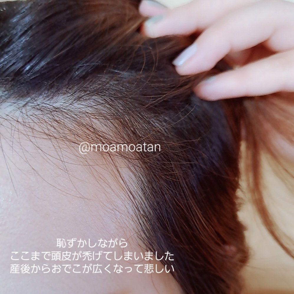 イクモアナノグロウリッチプレミアム/iqumore/頭皮ローションを使ったクチコミ(3枚目)