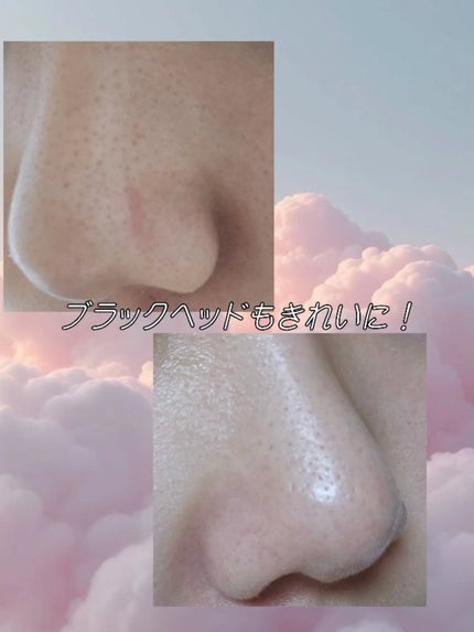 AZケア クレンジングオイル/VT/オイルクレンジングを使ったクチコミ(3枚目)