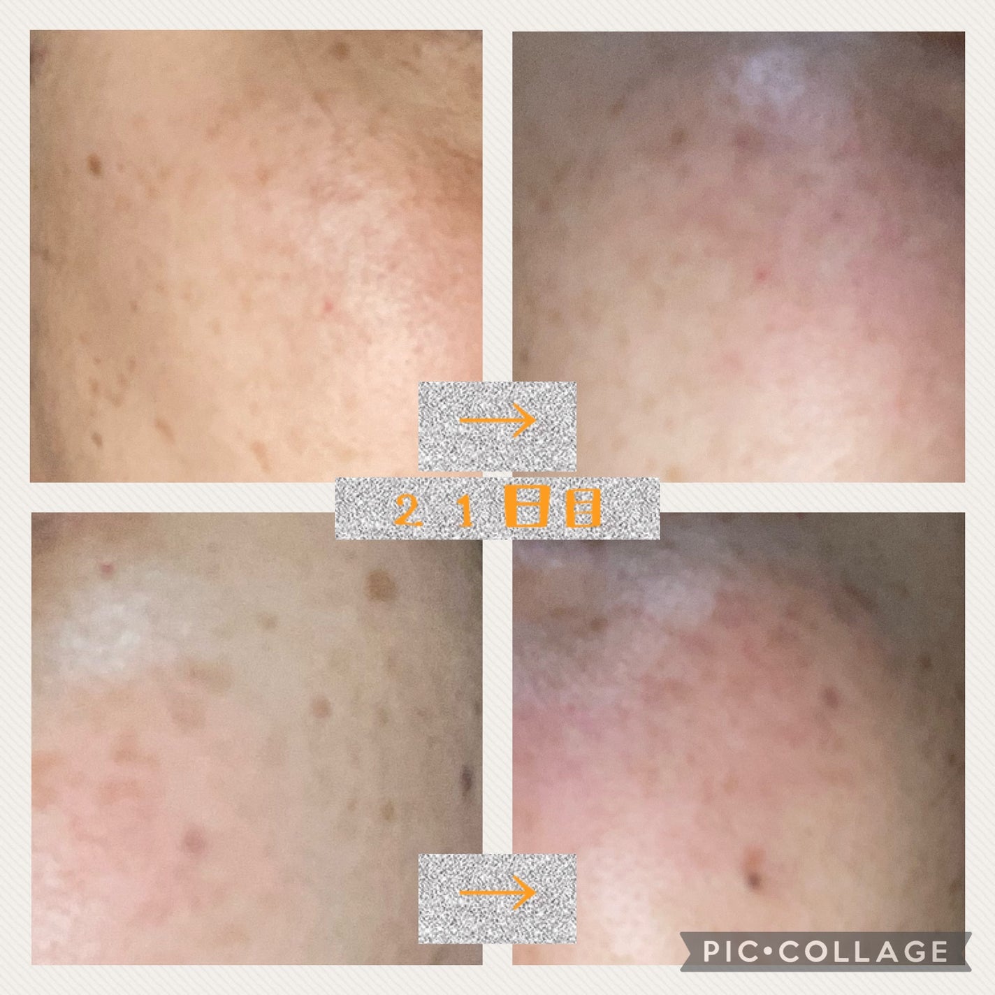 ハイドロクリームPHQ-8/KISO/美容液を使ったクチコミ(1枚目)