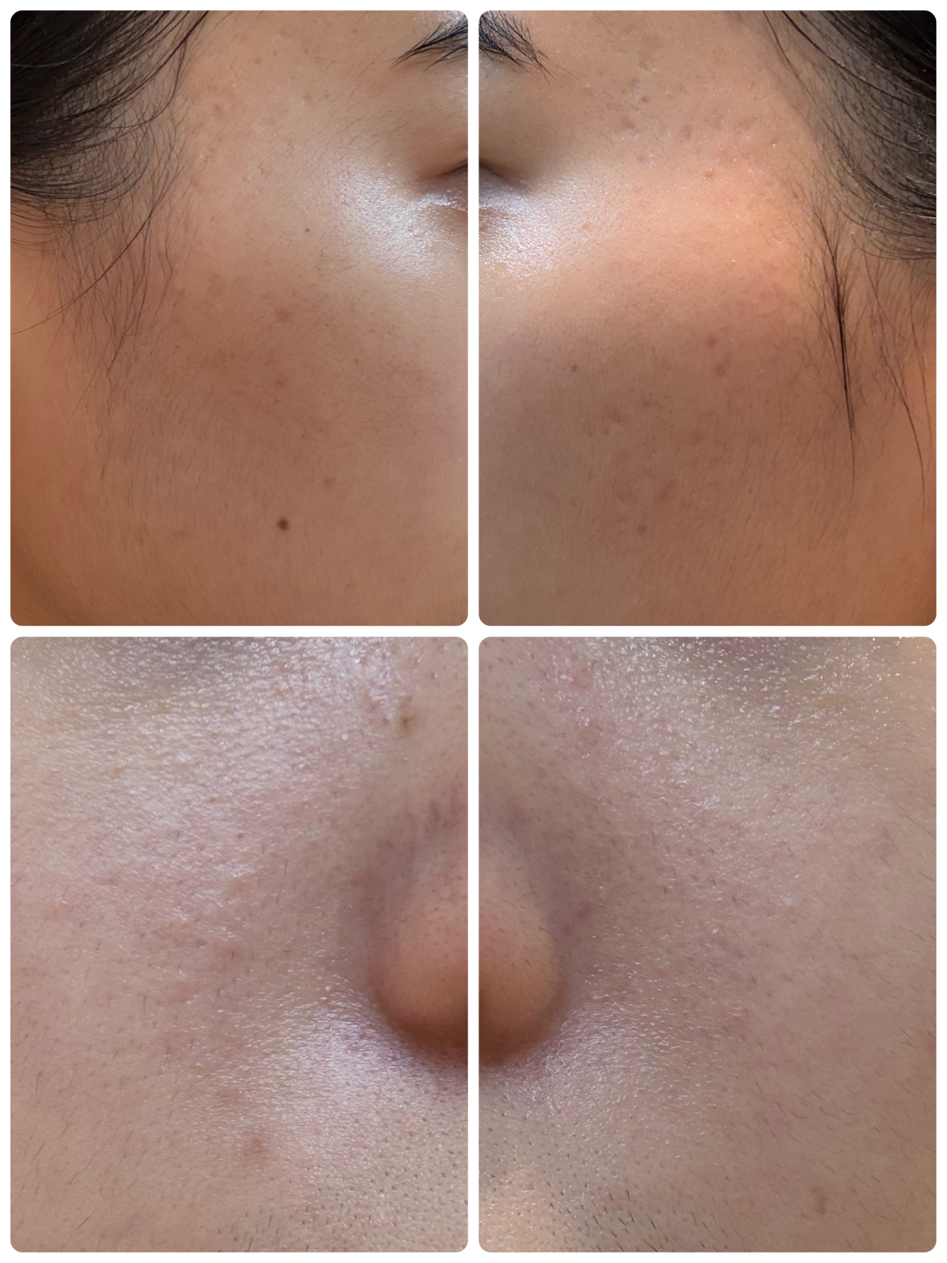 薬用雪肌精 ブライトニング クレンジング オイル[医薬部外品] 150mL/雪肌精/オイルクレンジングを使ったクチコミ（2枚目）