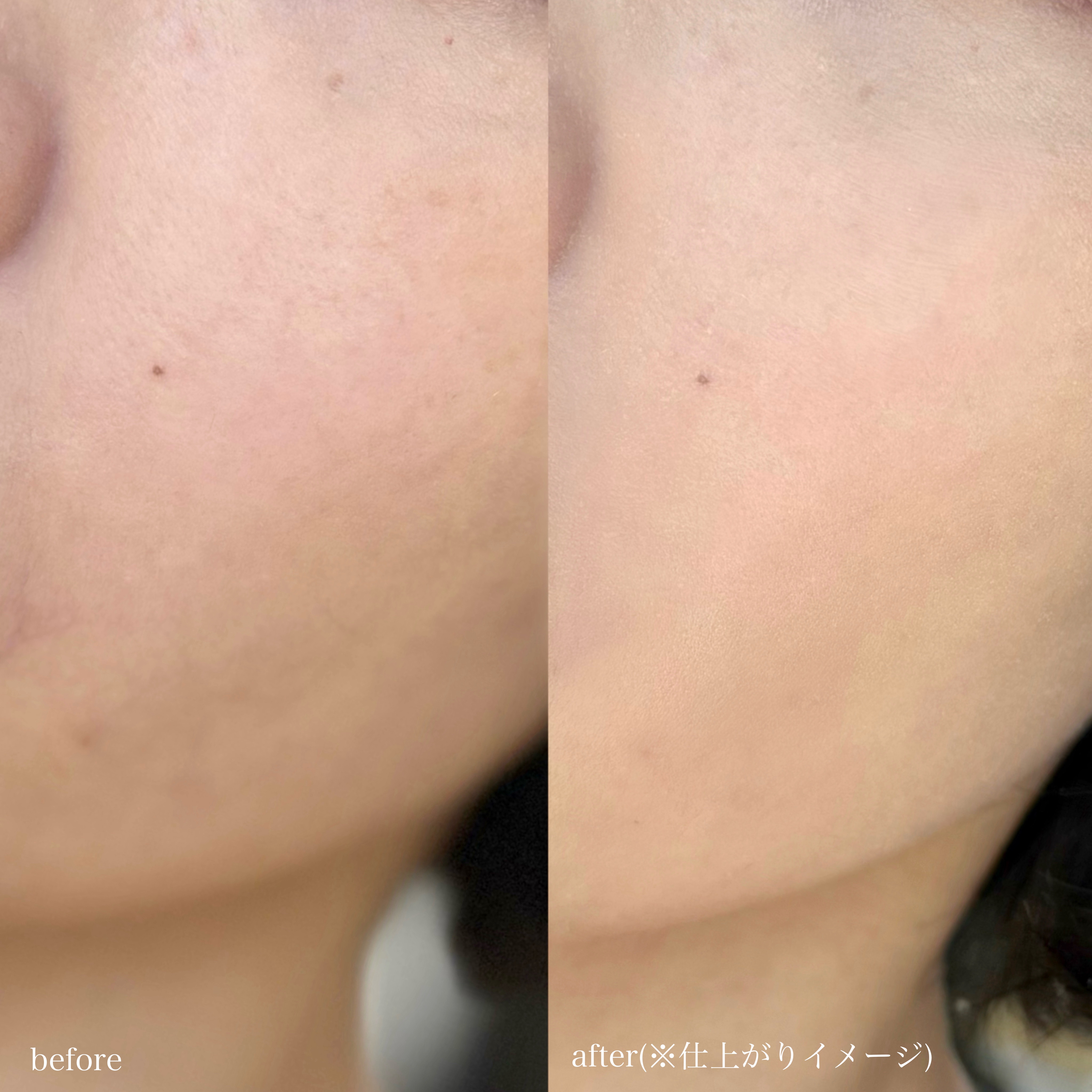 クリーム ファウンデイションe/IPSA/リキッドファンデーションを使ったクチコミ（3枚目）