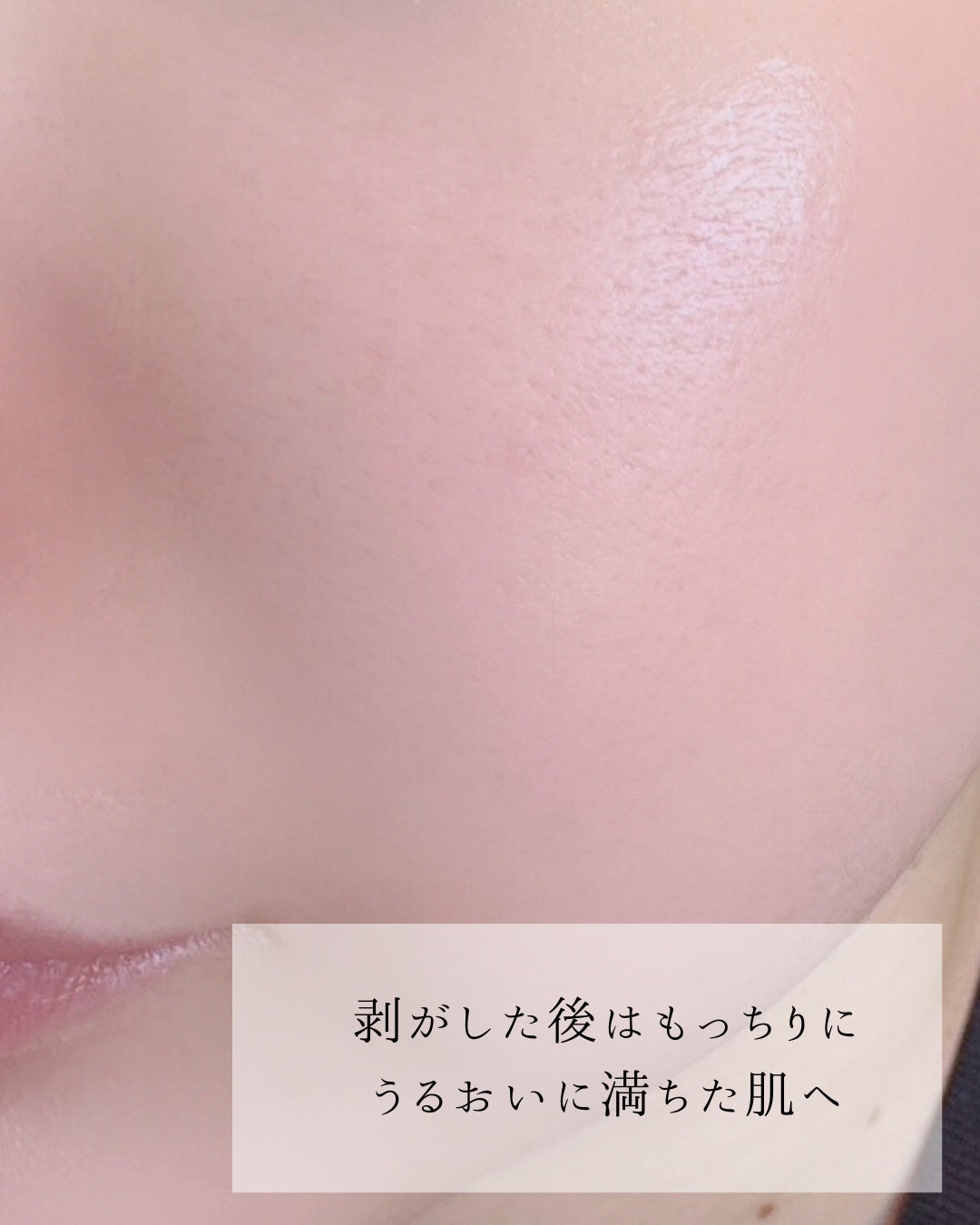 えむ。 投稿ある方フォロバ100リムバ100 on LIPS 「肌悩みに合わせて選べる4種類の集中ケア✨アンプル1本をそのまま..」(4枚目)