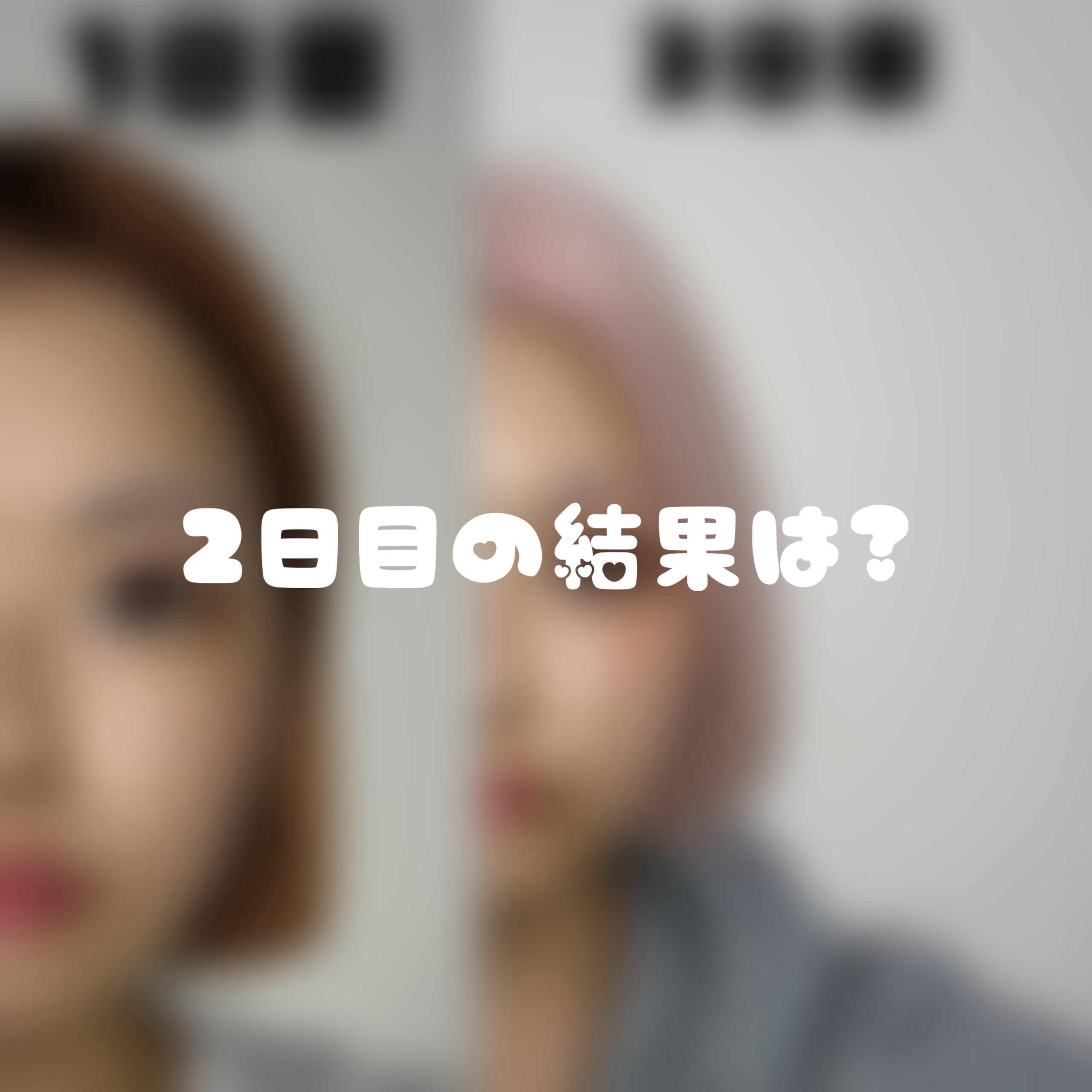 ドクダミ 77 スージングトナー/Anua/化粧水を使ったクチコミ（1枚目）