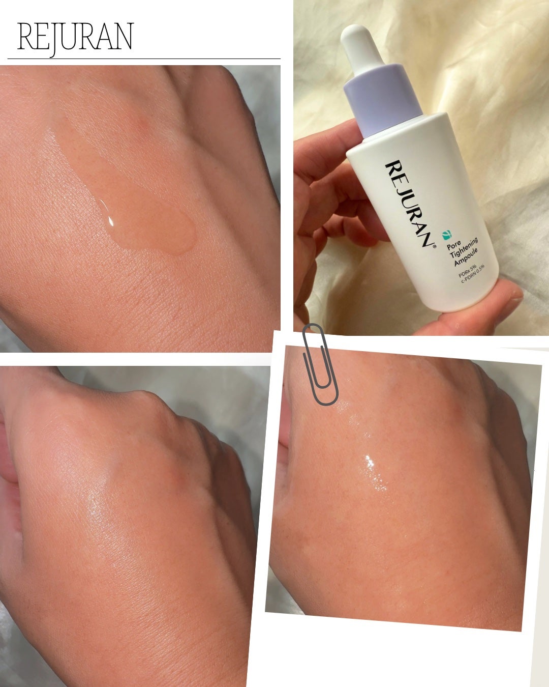 ダーマヒーラー ポアタイトニングアンプル 30ml/REJURAN COSMETICS/美容液を使ったクチコミ(2枚目)