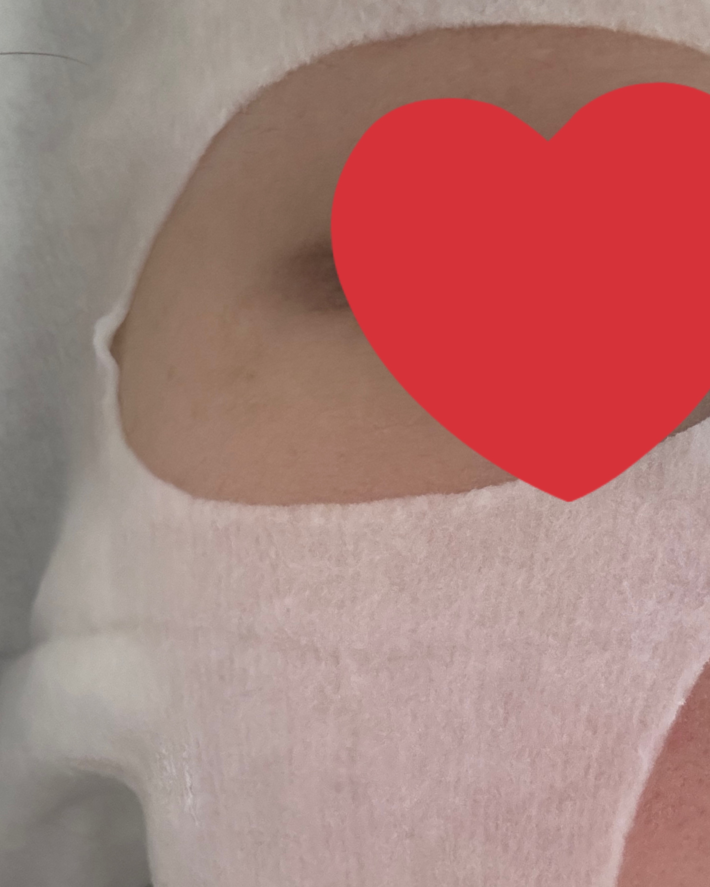 REJURAN ターンオーバーマスク(5枚入り)/REJURAN COSMETICS/シートマスク・パックを使ったクチコミ（3枚目）