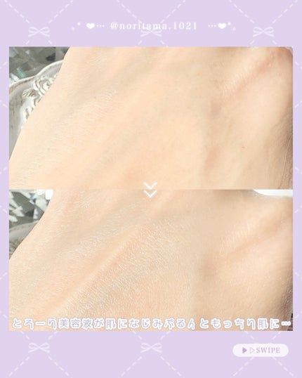 360度ショットPDRNアクティブセラム/センテリアン24/美容液を使ったクチコミ(5枚目)