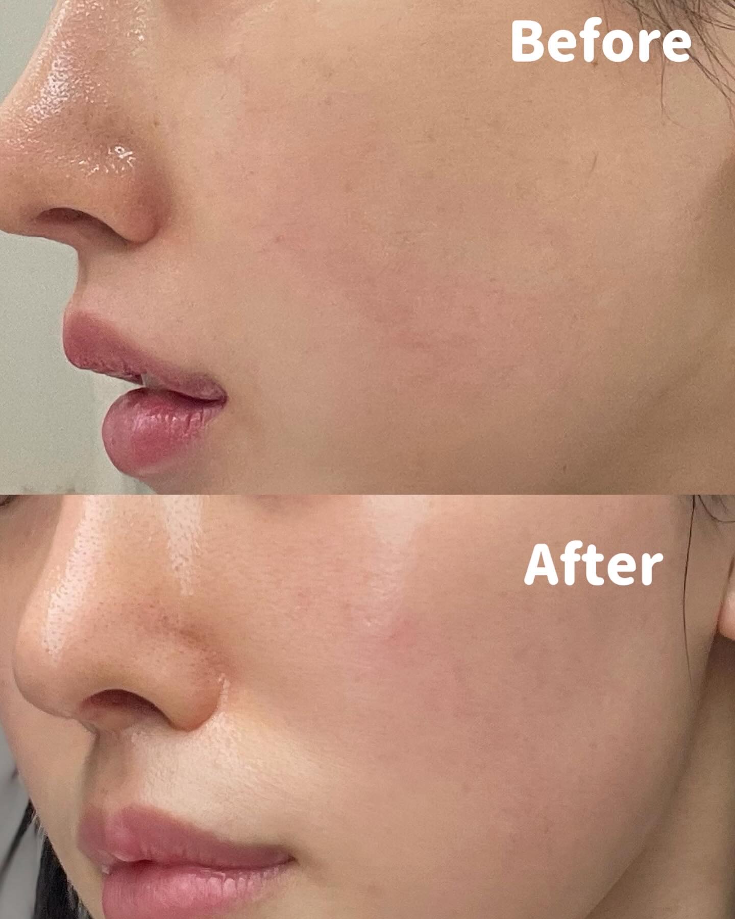 CICA マスククレンザー/VT/洗顔フォームを使ったクチコミ（3枚目）