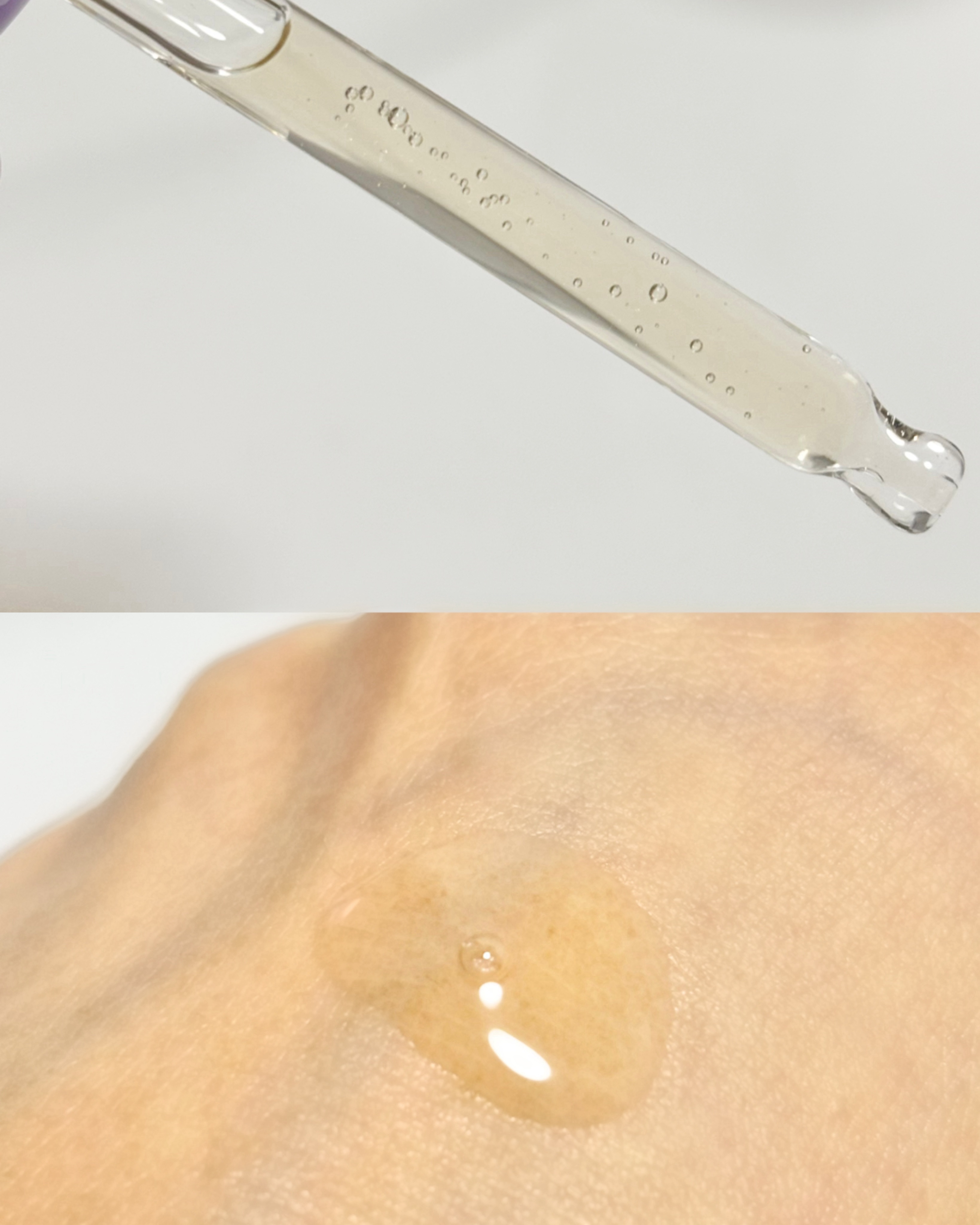 REJURAN ダーマヒーラー ポアタイトニングアンプル 30ml/REJURAN COSMETICS/美容液を使ったクチコミ（3枚目）