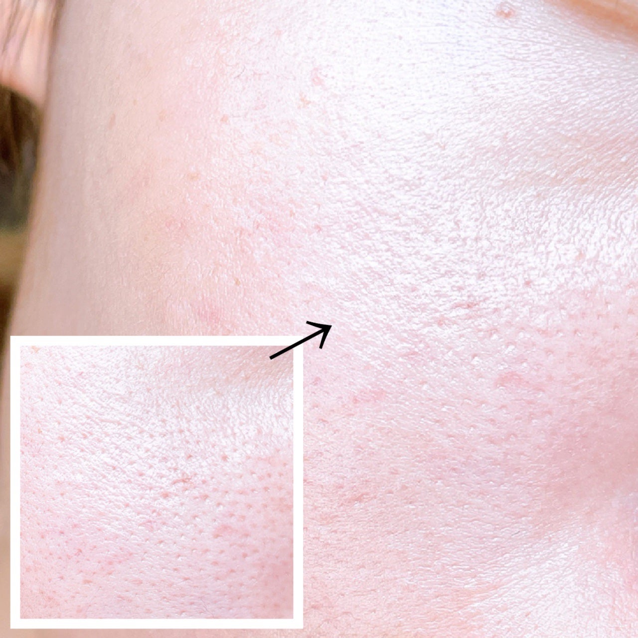 UVイデア XL プロテクショントーンアップ ローズ+/ラ ロッシュ ポゼ/日焼け止め・UVケアを使ったクチコミ(5枚目)