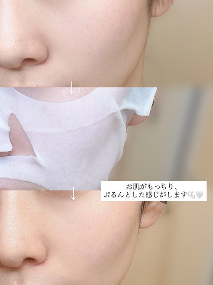 REJURAN ターンオーバーマスク(5枚入り)/REJURAN COSMETICS/シートマスク・パックを使ったクチコミ(4枚目)