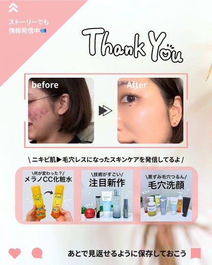 なぎ | スキンケア薬剤師 on LIPS 「肌トラブルに要注意⚠️こんばんは、なぎです💡徐々に秋めいた気候..」(9枚目)