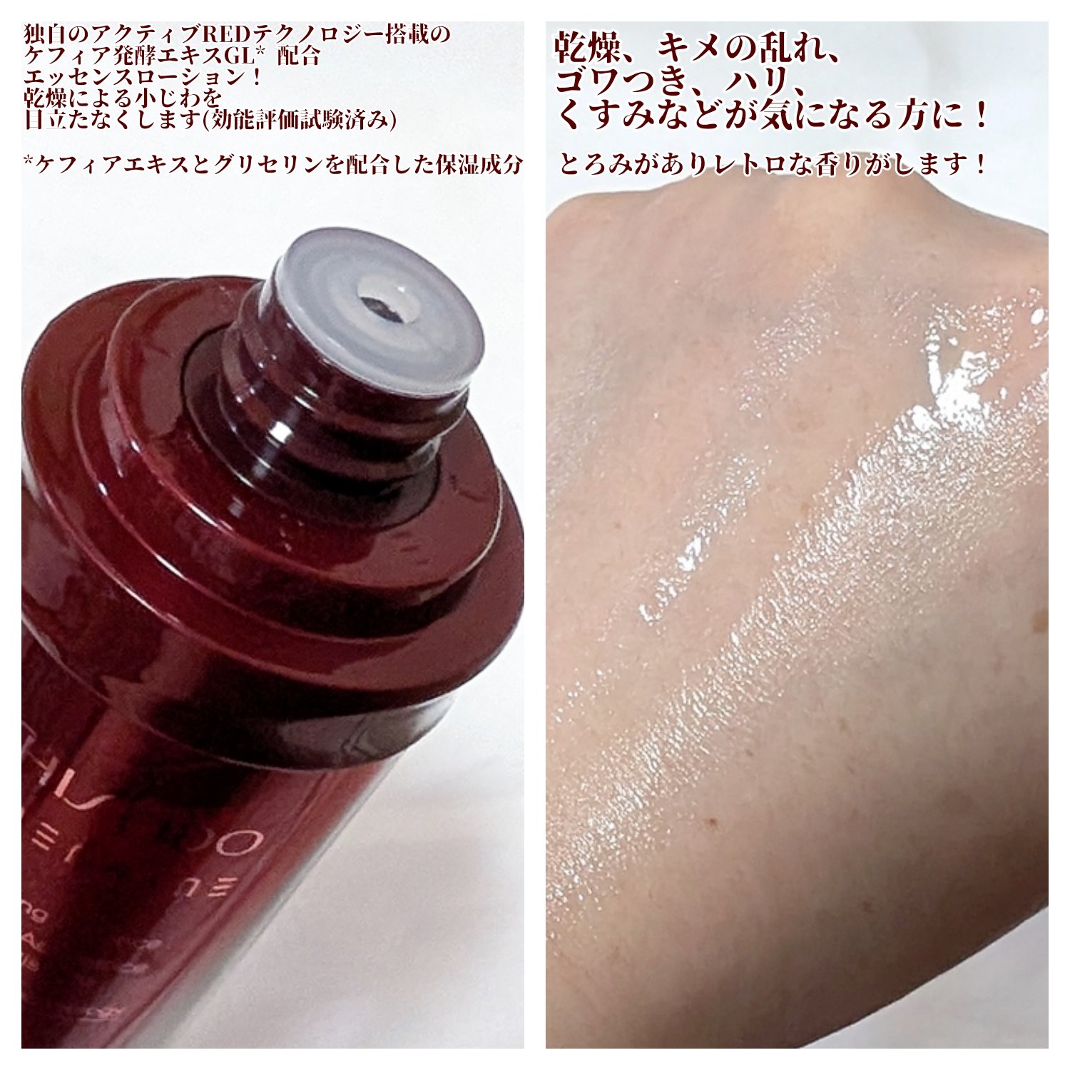 オイデルミン エッセンスローション/SHISEIDO/化粧水を使ったクチコミ（2枚目）