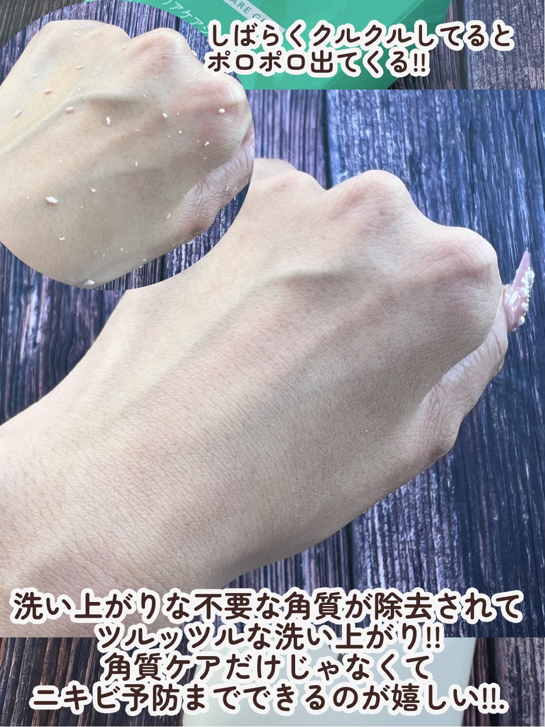 NIKIPITA 薬用GG角質クリアケアジェル/NIKI PITA/ピーリングを使ったクチコミ(5枚目)