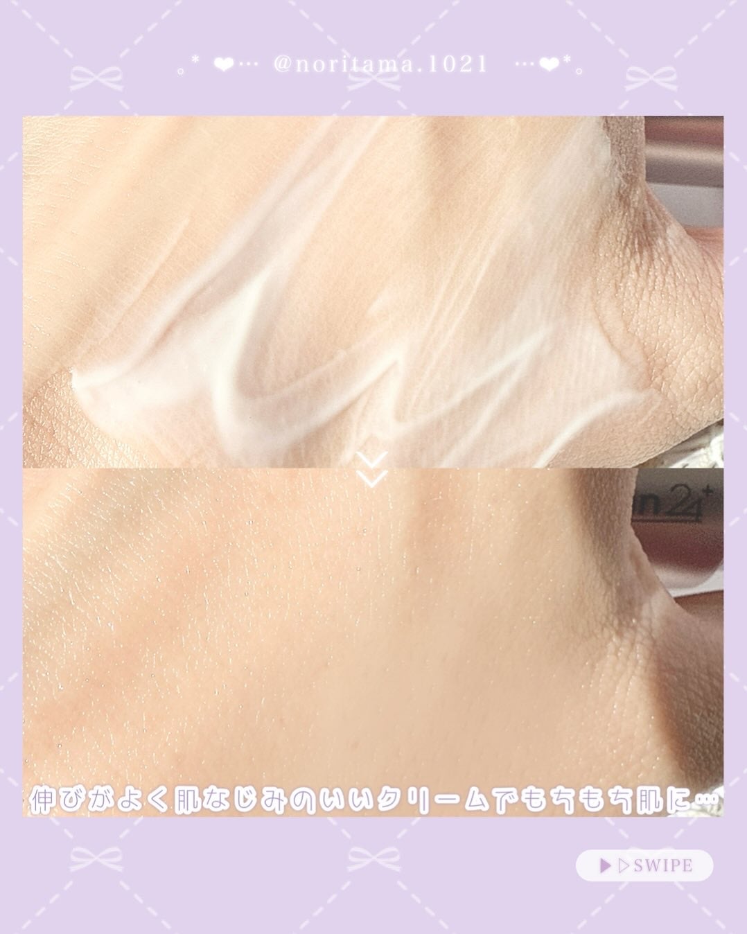 360度ショットPDRNアクティブセラム/センテリアン24/美容液を使ったクチコミ(3枚目)