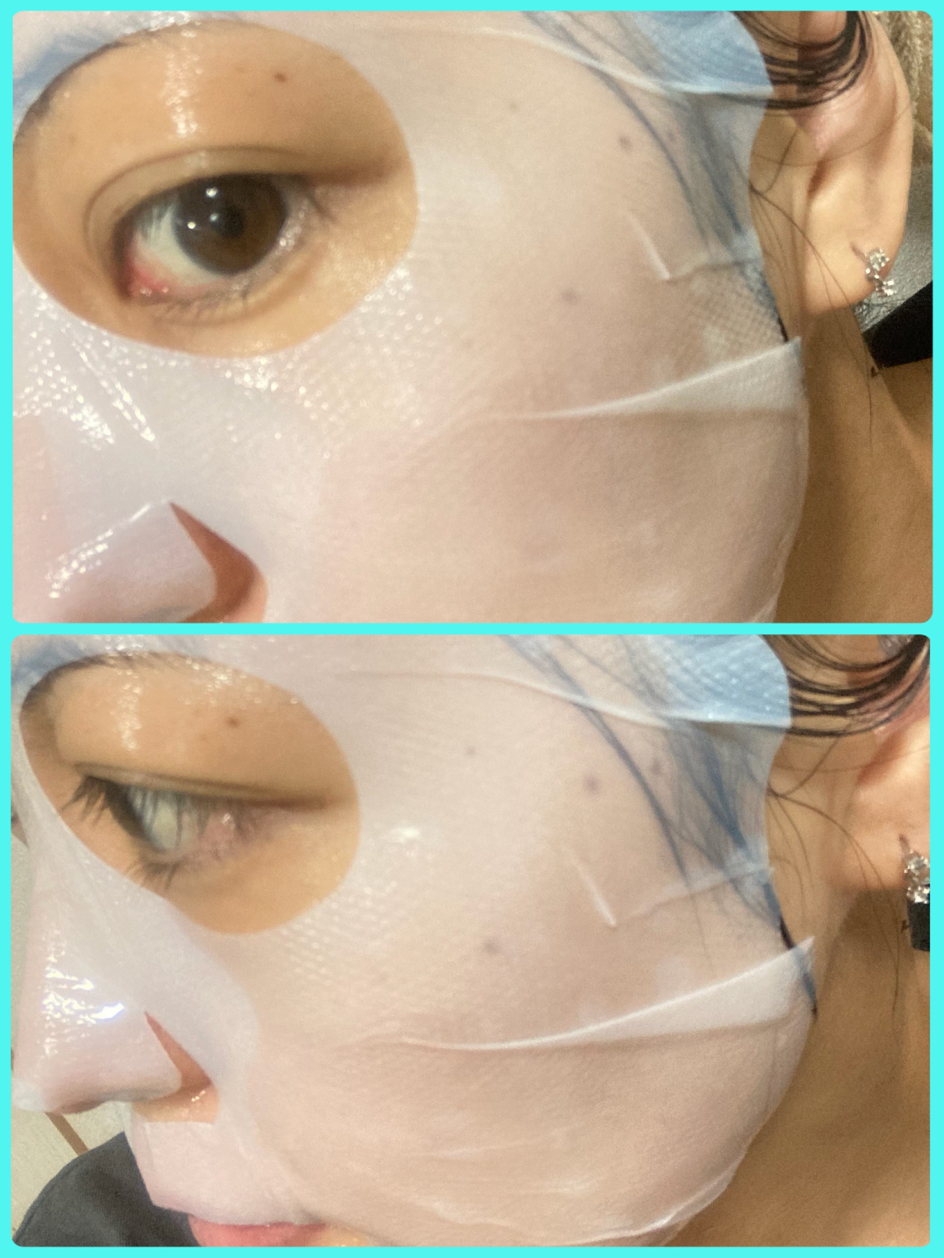 サミュ ガラクトポア ディープクリーン 2ステップマスク/SAM'U/シートマスク・パックを使ったクチコミ（3枚目）