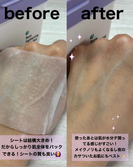 ポアタイトニングトナーパッド/REJURAN COSMETICS/トナーパッドを使ったクチコミ(4枚目)