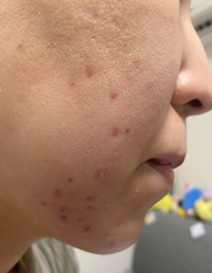 を使ったクチコミ(2枚目)