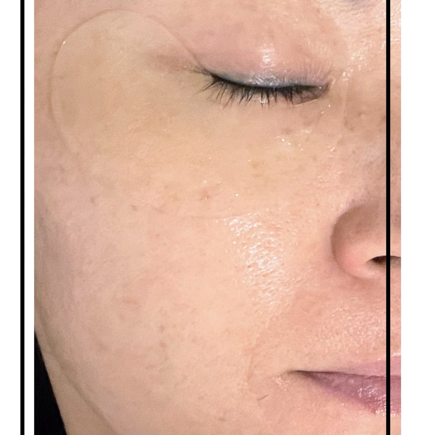 ビオリカ レチノール&セラミド配合(*5) ハイドロゲル ポイントマスク /ドウシシャ/シートマスク・パックを使ったクチコミ(6枚目)