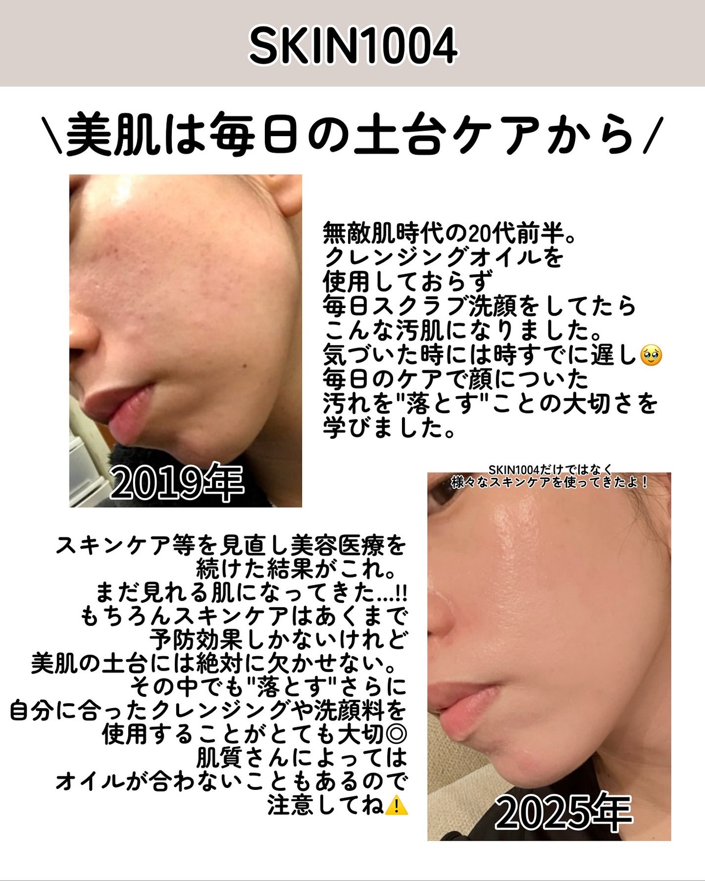 kotori_フォロバ100! on LIPS 「✨美肌は毎日の「土台ケア」から✨日々の汚れや大気中の微粒子は放..」(2枚目)