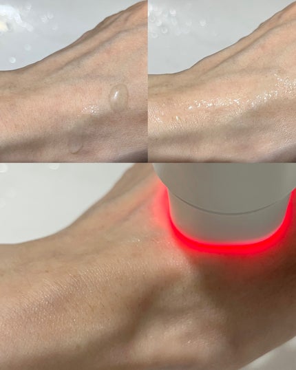 ダーマアンサーアゼライン酸ミントアンプル/CNP Laboratory/美容液を使ったクチコミ(5枚目)