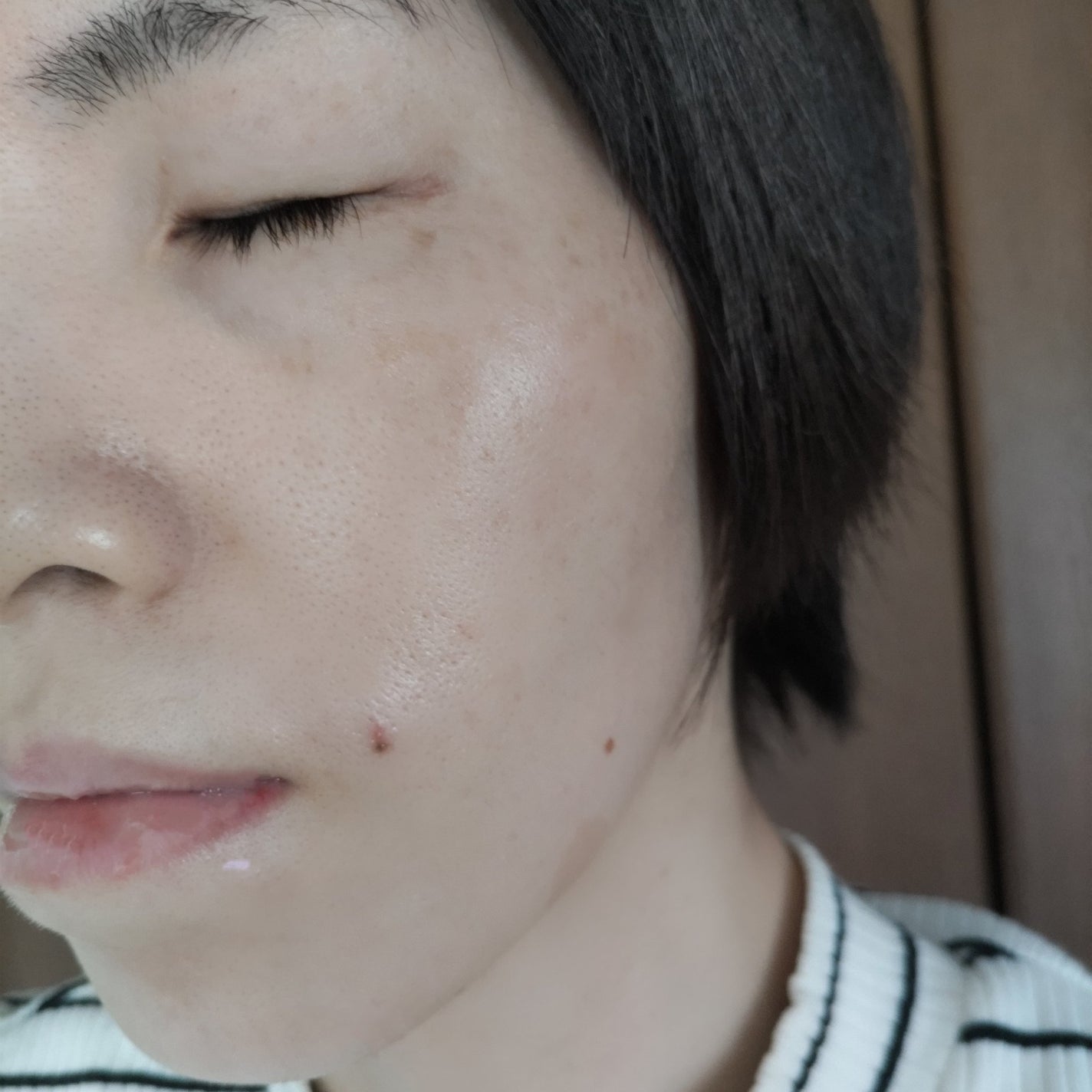 PDRN+リードルS 100/VT/美容液を使ったクチコミ(9枚目)