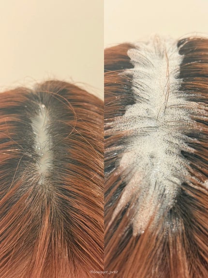 スパークリングスカルプスケーラー/ミンツリー/頭皮ケアを使ったクチコミ(7枚目)