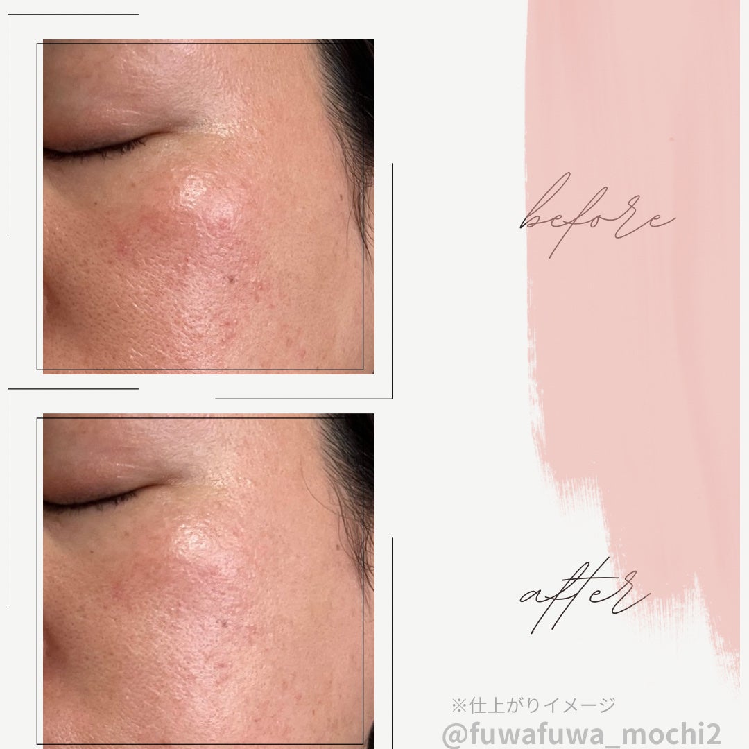 UVã€ã㢠XL ãããã¯ã·ã§ã³ããŒã³ã¢ãã ããŒãº+/ã© ããã·ã¥ ããŒ/æ¥çŒãæ¢ãã»UVã±ã¢ã䜿ã£ãã¯ãã³ãïŒ3æç®ïŒ