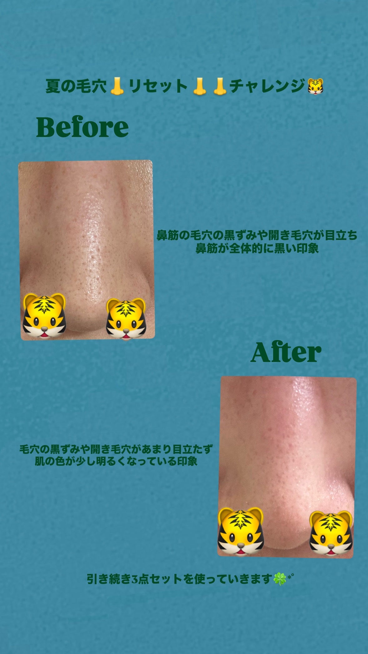 シカレチA エッセンス0.1/VT/美容液を使ったクチコミ(3枚目)