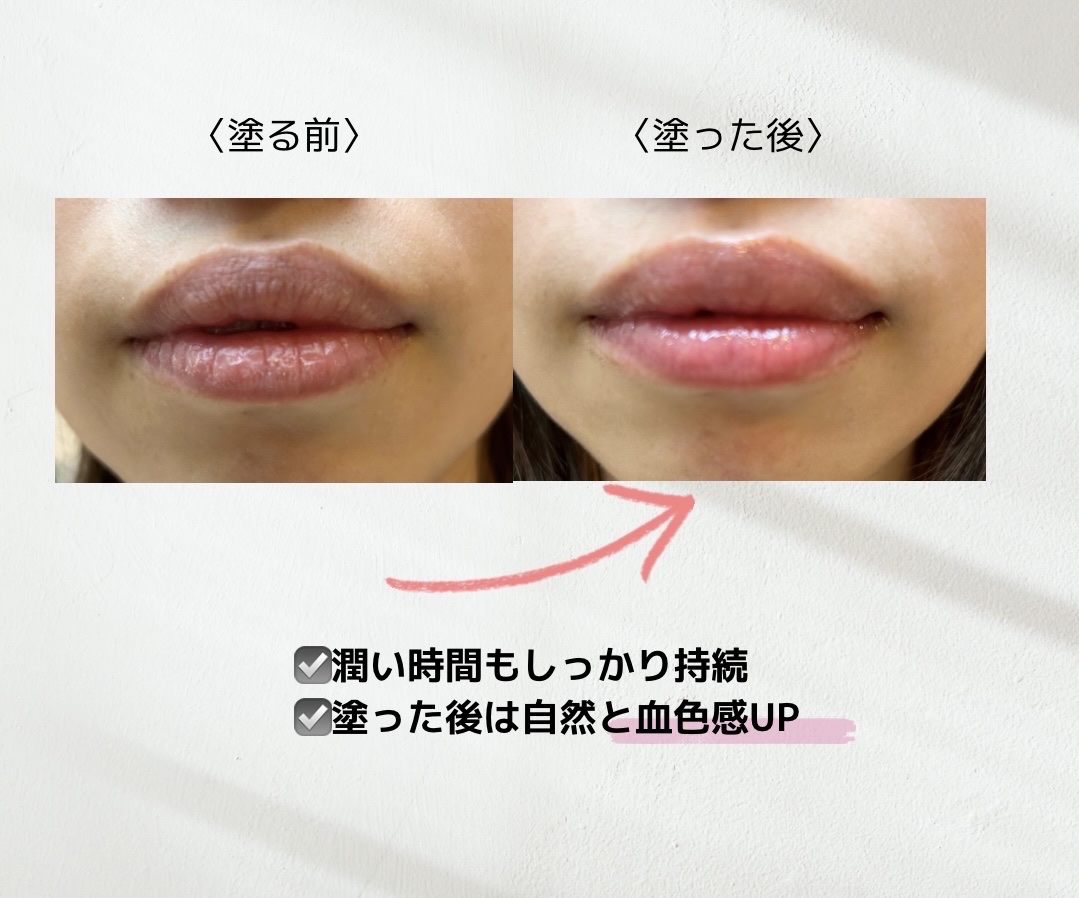 リップケア バーム/キュレル/リップバームを使ったクチコミ（3枚目）