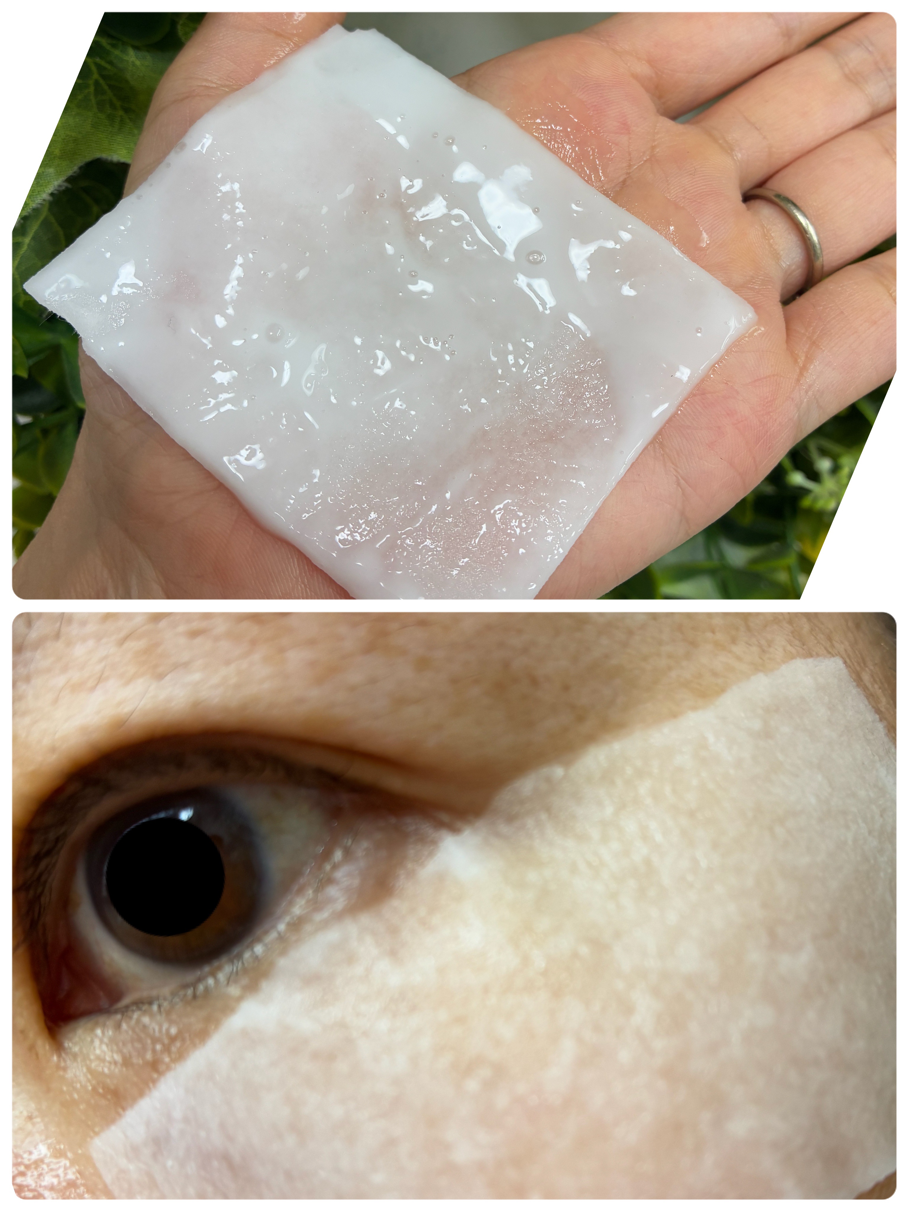 リズム ピコレーザー ニードルスポットパック/RISM/シートマスク・パックを使ったクチコミ（2枚目）