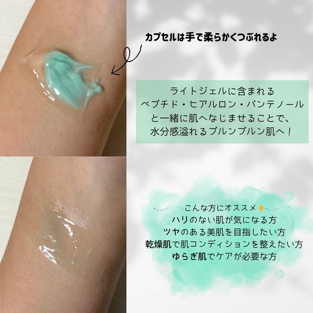 noað on LIPS ãæè¿è©±é¡ã®VTPDRNã¯ãªãŒã âšèåçæåãšåŒã°ããPDRNã..ãïŒ3æç®ïŒ