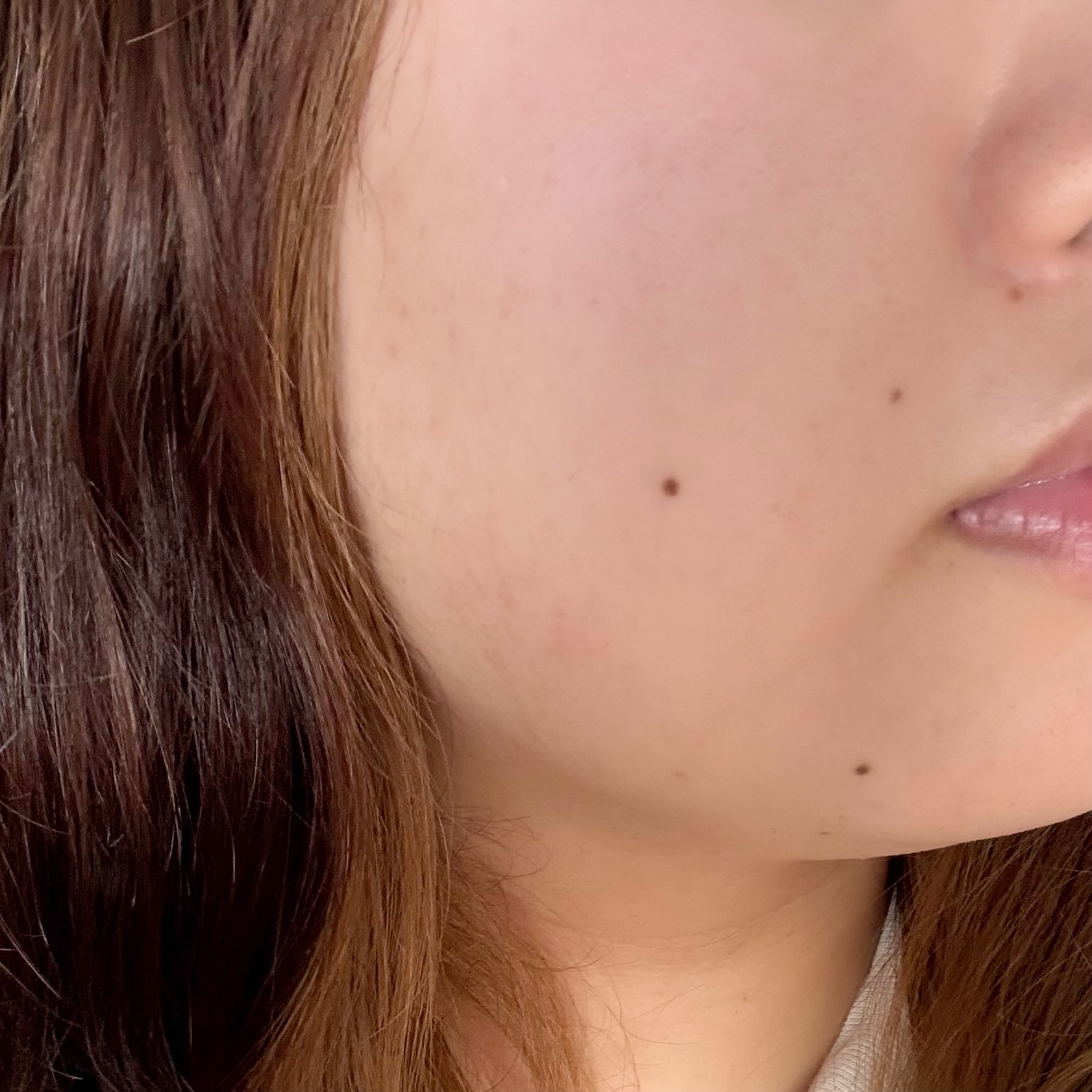 C×AZ ダーマインショット200/ESIENCE/美容液を使ったクチコミ（3枚目）