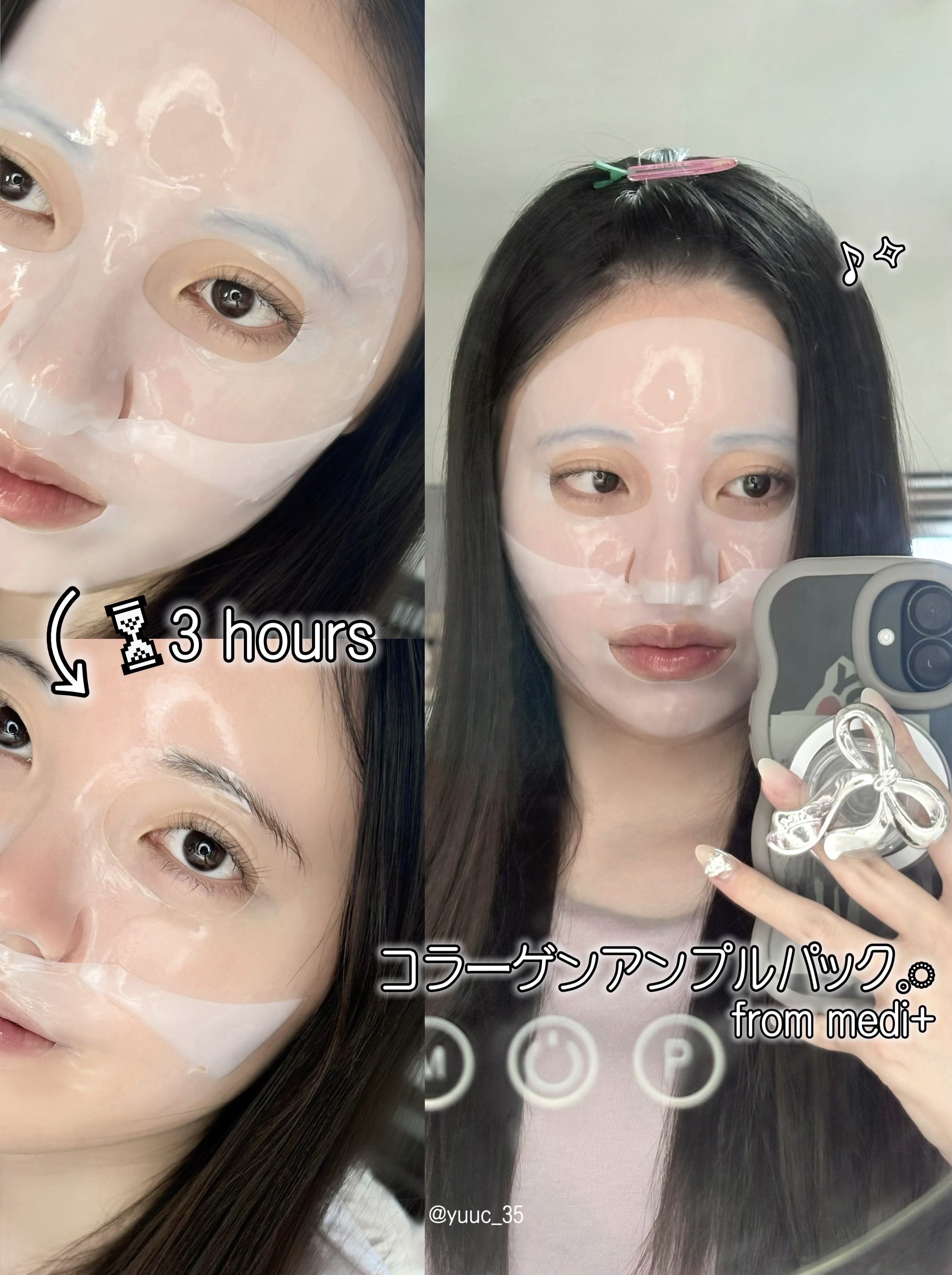 ナノステップ コラーゲン メルティングマスク/from medi+/シートマスク・パックを使ったクチコミ（1枚目）
