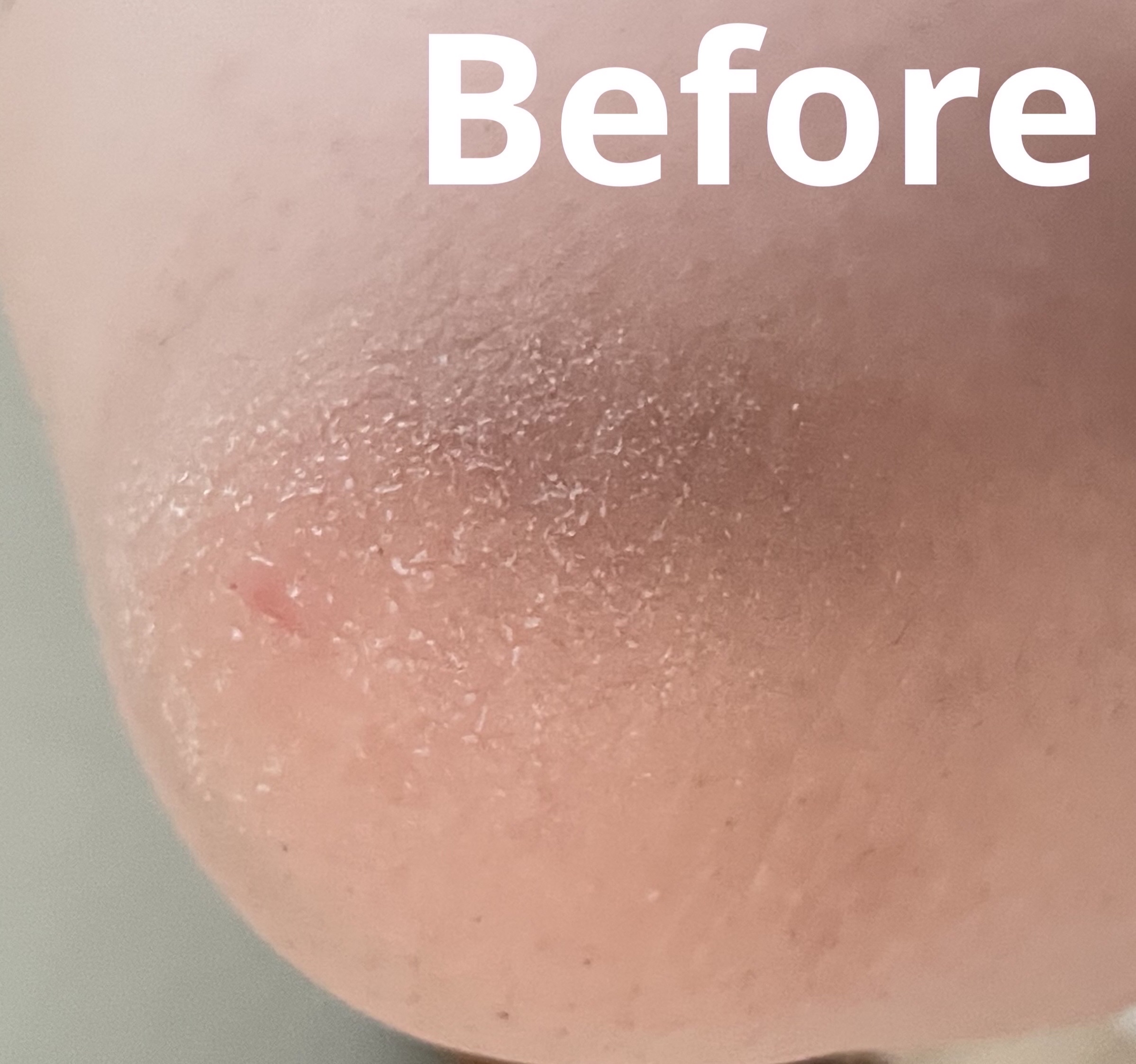 メディータム20E（医薬品）/ラクール/その他を使ったクチコミ（2枚目）