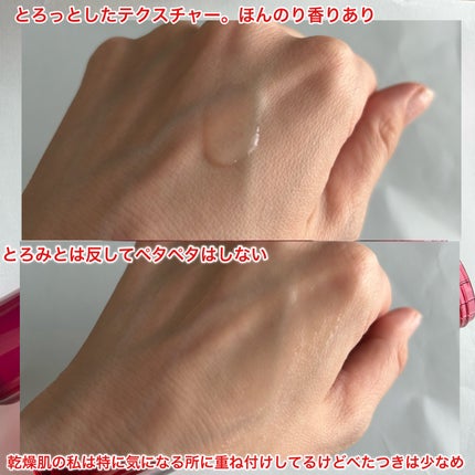 オイデルミン エッセンスローション/SHISEIDO/化粧水を使ったクチコミ(4枚目)