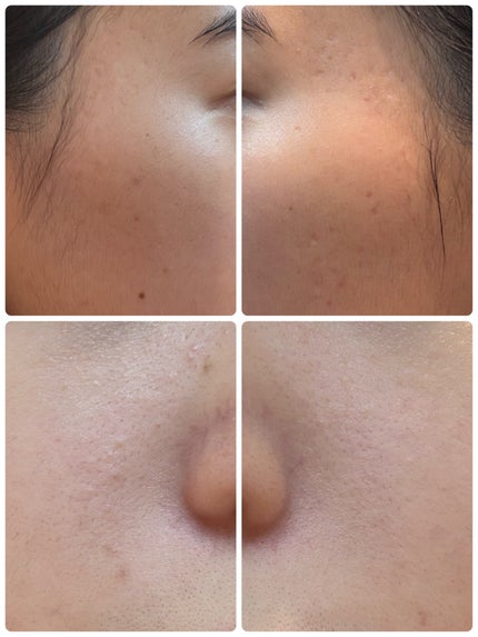 エターナルアイクリーム 8g/リュバンブラン/アイケア・アイクリームを使ったクチコミ(2枚目)