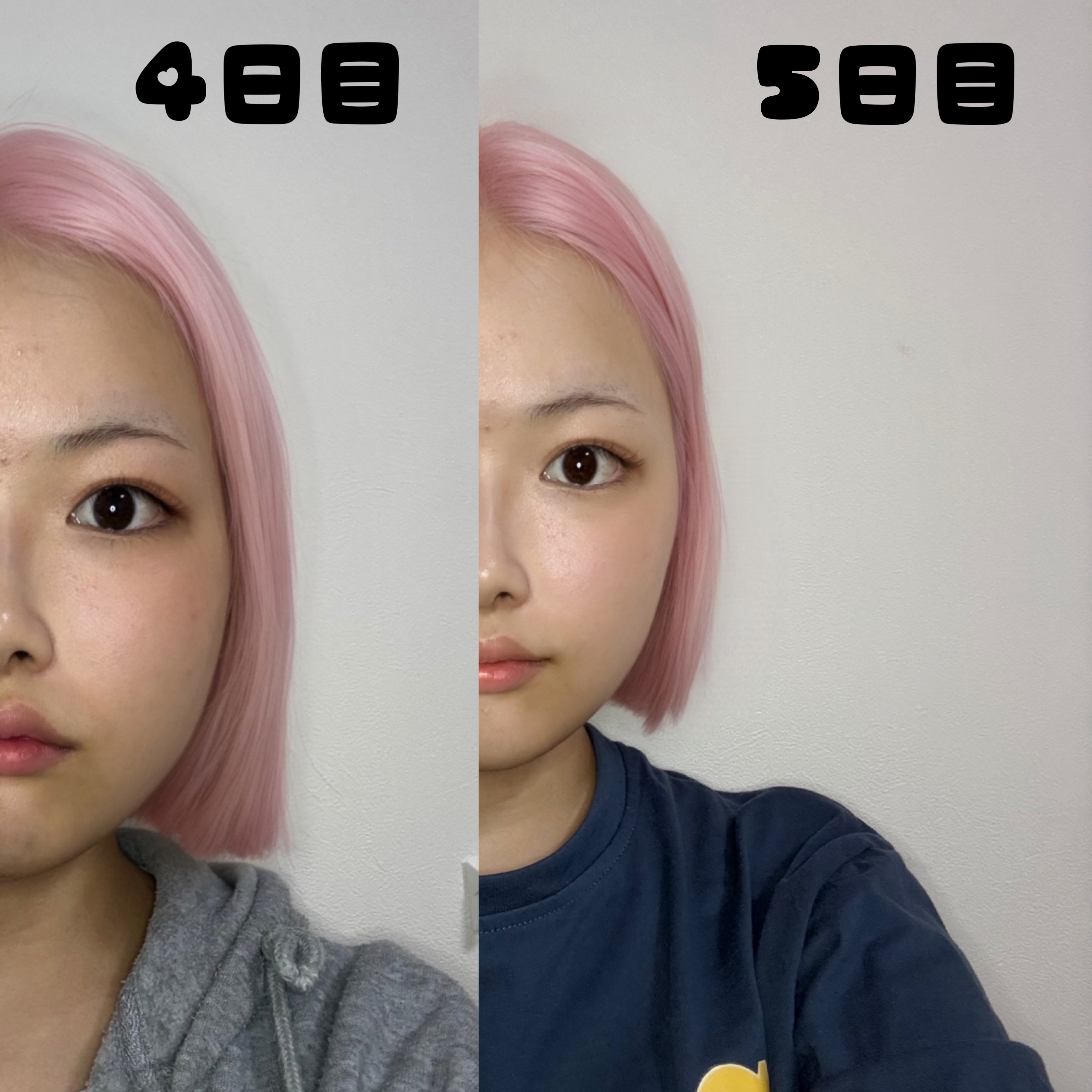 薬用しみ対策 美白化粧水/メラノCC/化粧水を使ったクチコミ（2枚目）