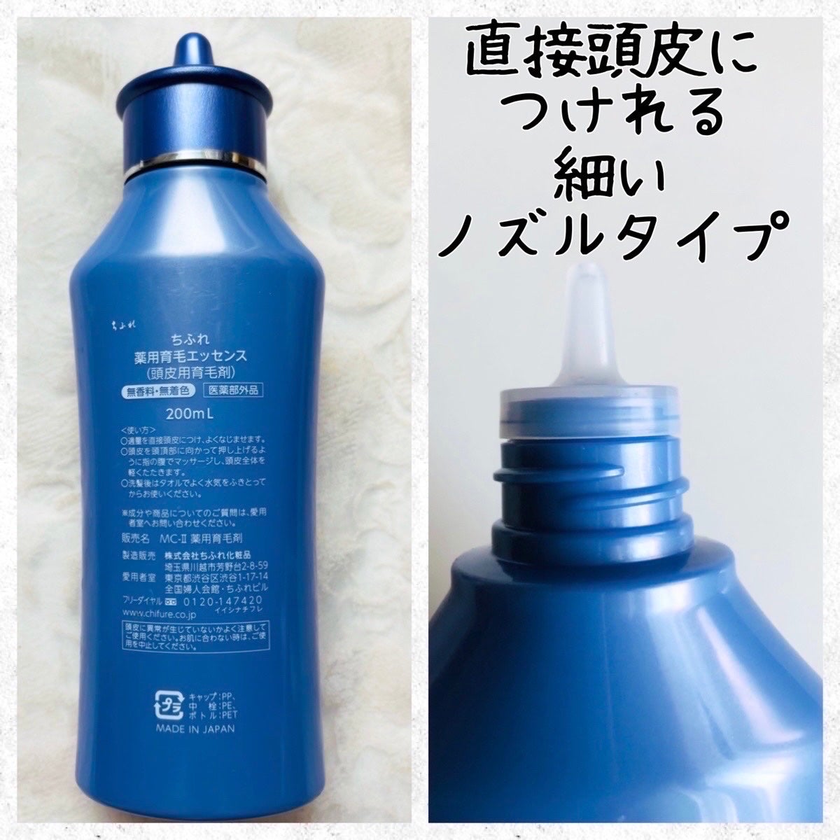 薬用育毛エッセンス(頭皮用育毛剤)/ちふれ/頭皮ローションを使ったクチコミ(2枚目)