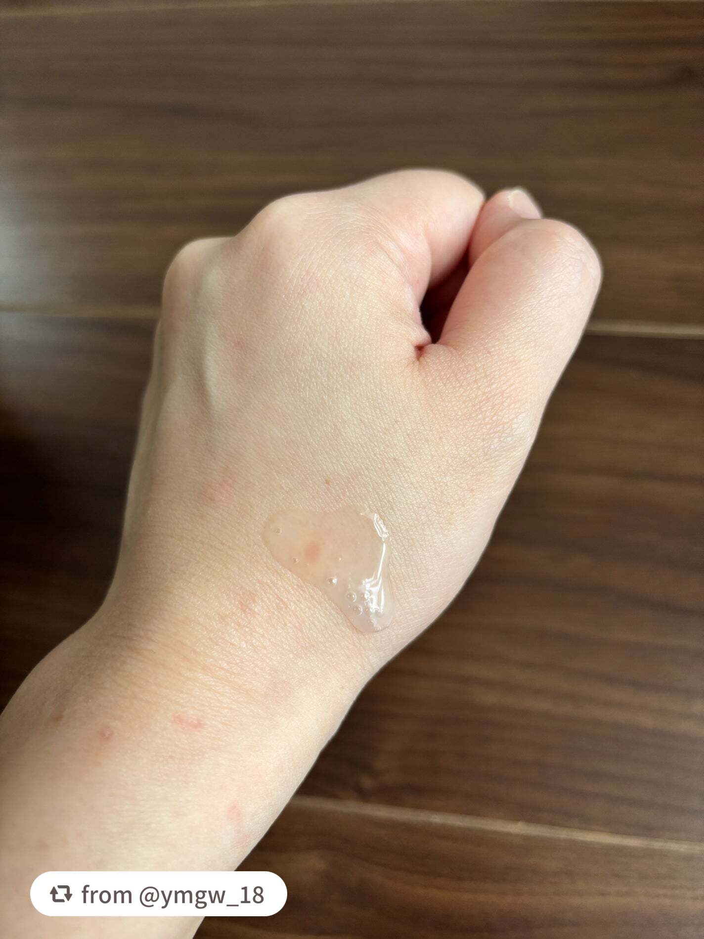 モイスチュア ローション/カルテHD/化粧水を使ったクチコミ(2枚目)