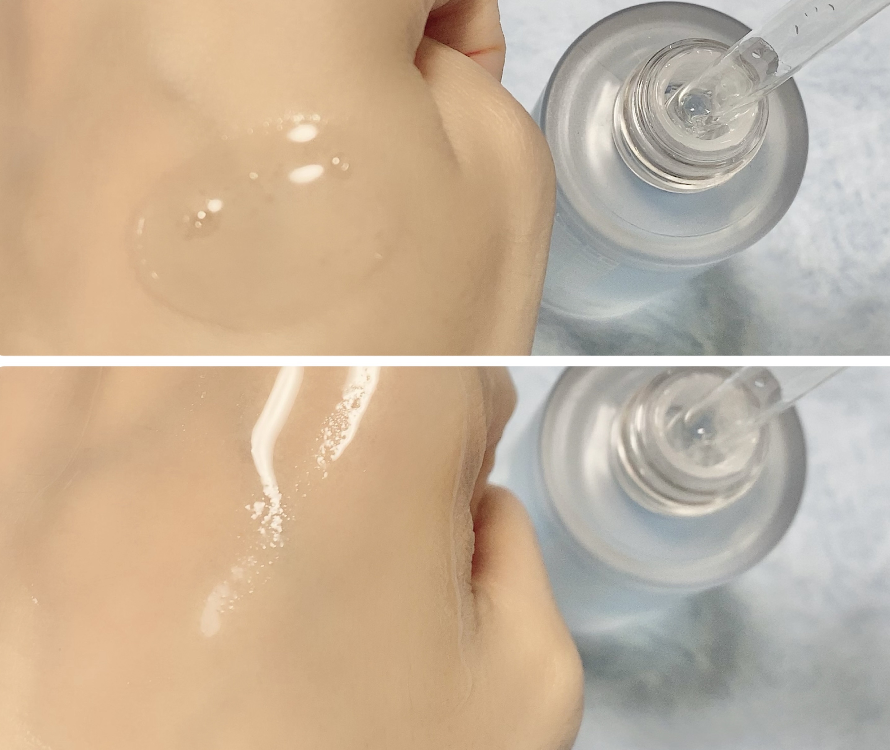 ハイドラAアンプル/Dr.lonnie/美容液を使ったクチコミ（3枚目）